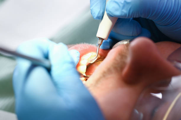 Best Emergency Root Canal Treatment in Carter, TX